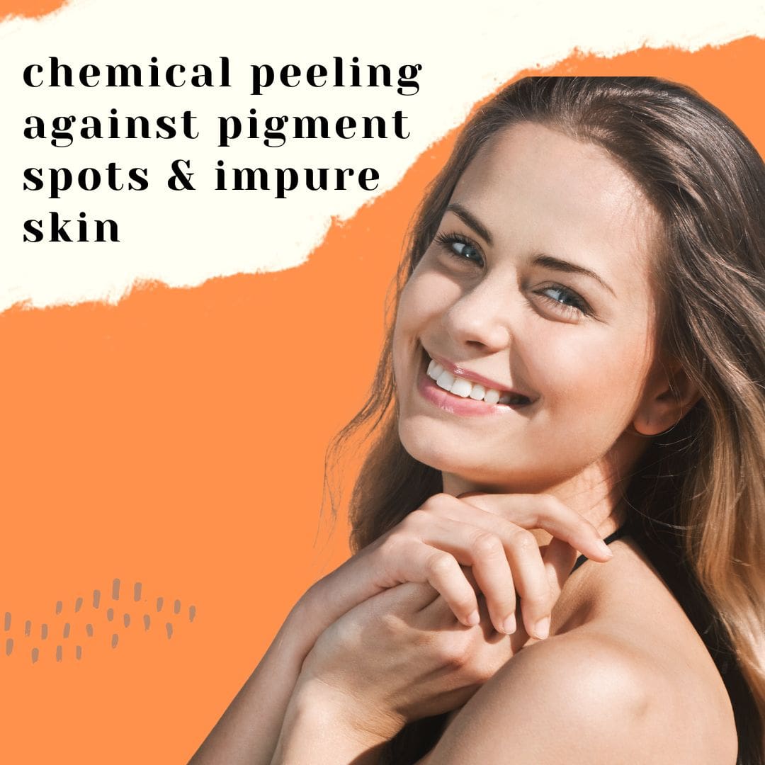 chemische peeling tegen pigmentvlekken & onzuivere huid